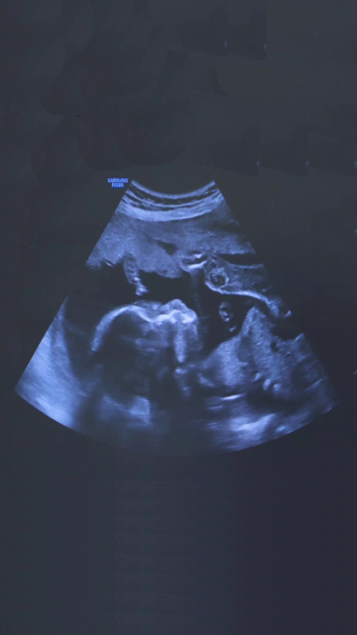 Sonography's Trailer