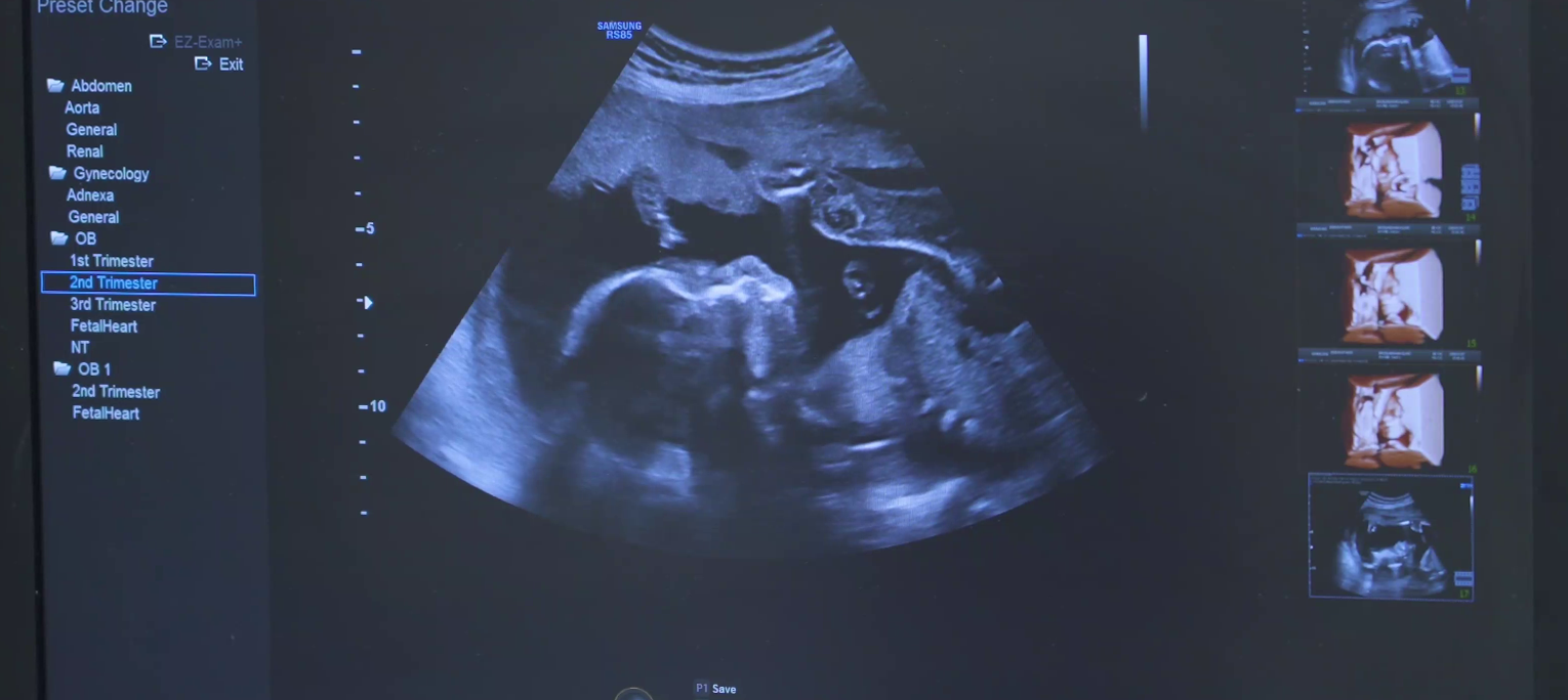 Sonography's Trailer